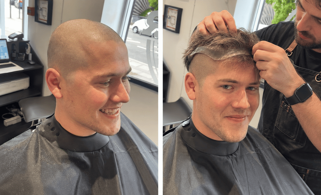 Going Bald? Why Men Choose Hair Systems Over Shaving 